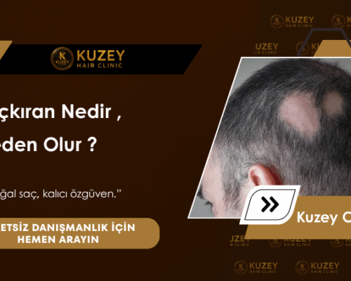 Saçkıran Nedir, Neden Olur?