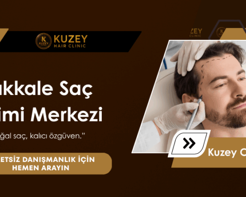 Kırıkkale Saç Ekim Merkezi