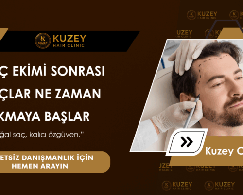 SAÇ EKİMİ SONRASI SAÇLAR NE ZAMAN ÇIKMAYA BAŞLAR