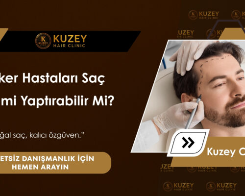 Şeker Hastaları Saç Ekimi Yaptırabilir Mi?