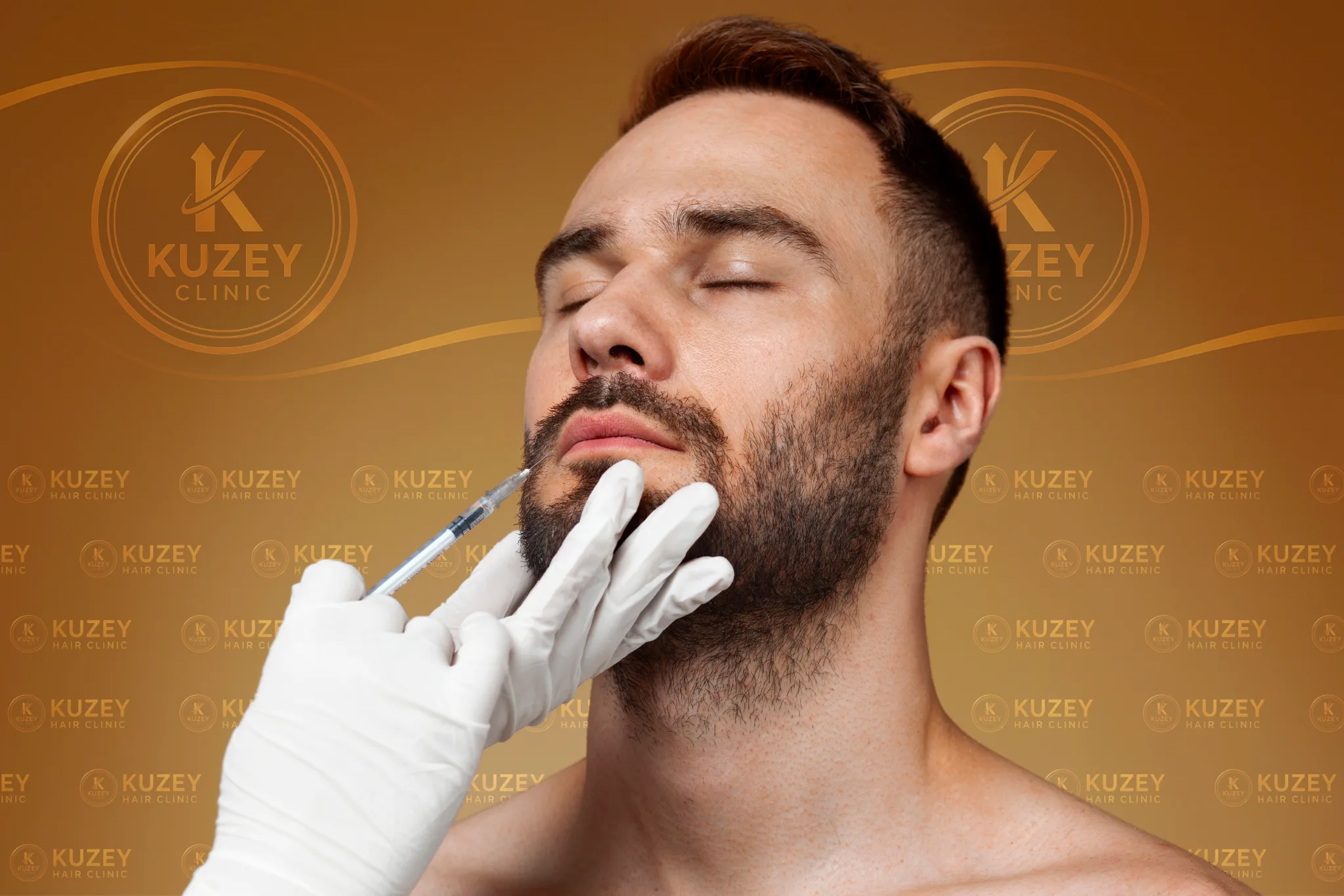 Kuzey Clinic sakal ve bıyık ekimi