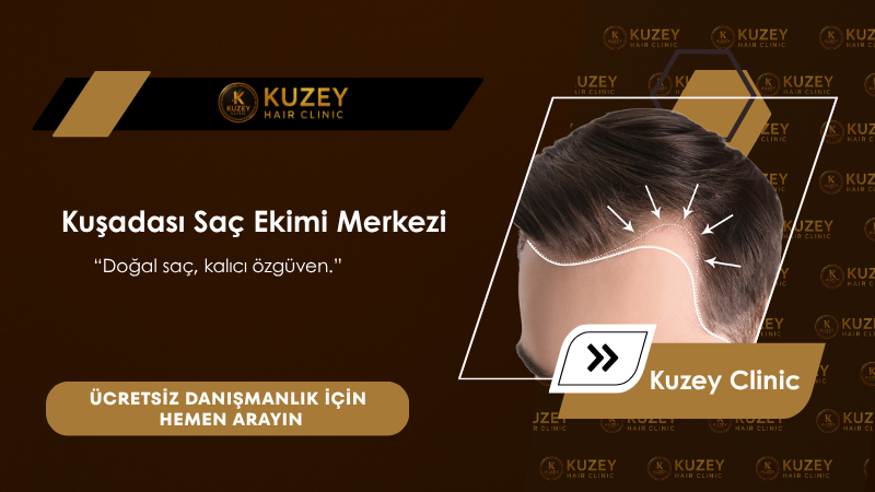 kusadasi sac ekim