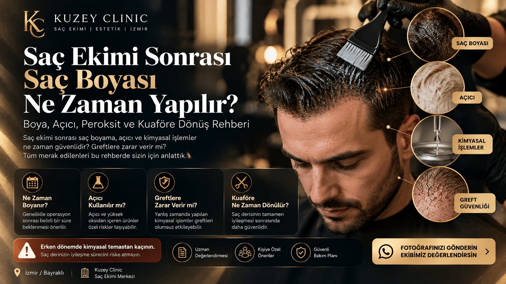Saç Ekimi Sonrası Saç Boyası Ne Zaman Yapılır? Açıcı, Peroksit ve Kimyasal İşlemler Rehberi - Kuzey Clinic İzmir
