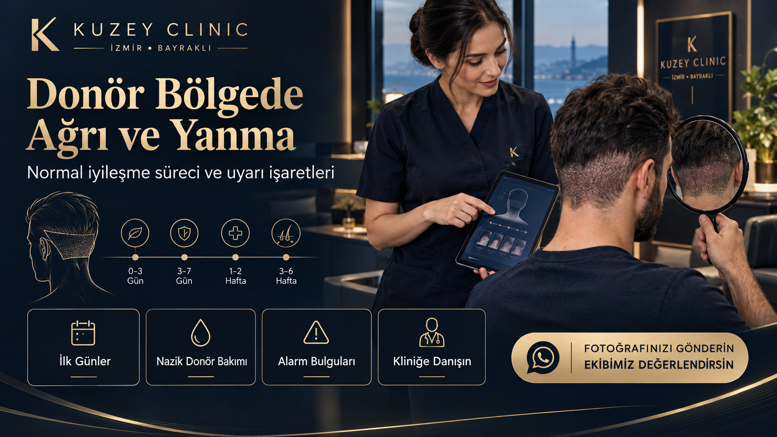 Saç Ekimi Sonrası Donör Bölgede Ağrı ve Yanma Ne Zaman Geçer   Kuzey Clinic İzmir