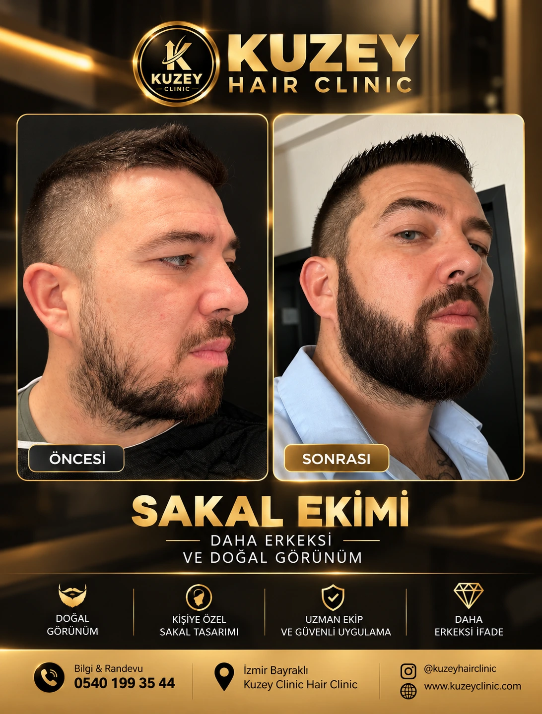 Kuzey Clinic sakal ekimi sonucu 4