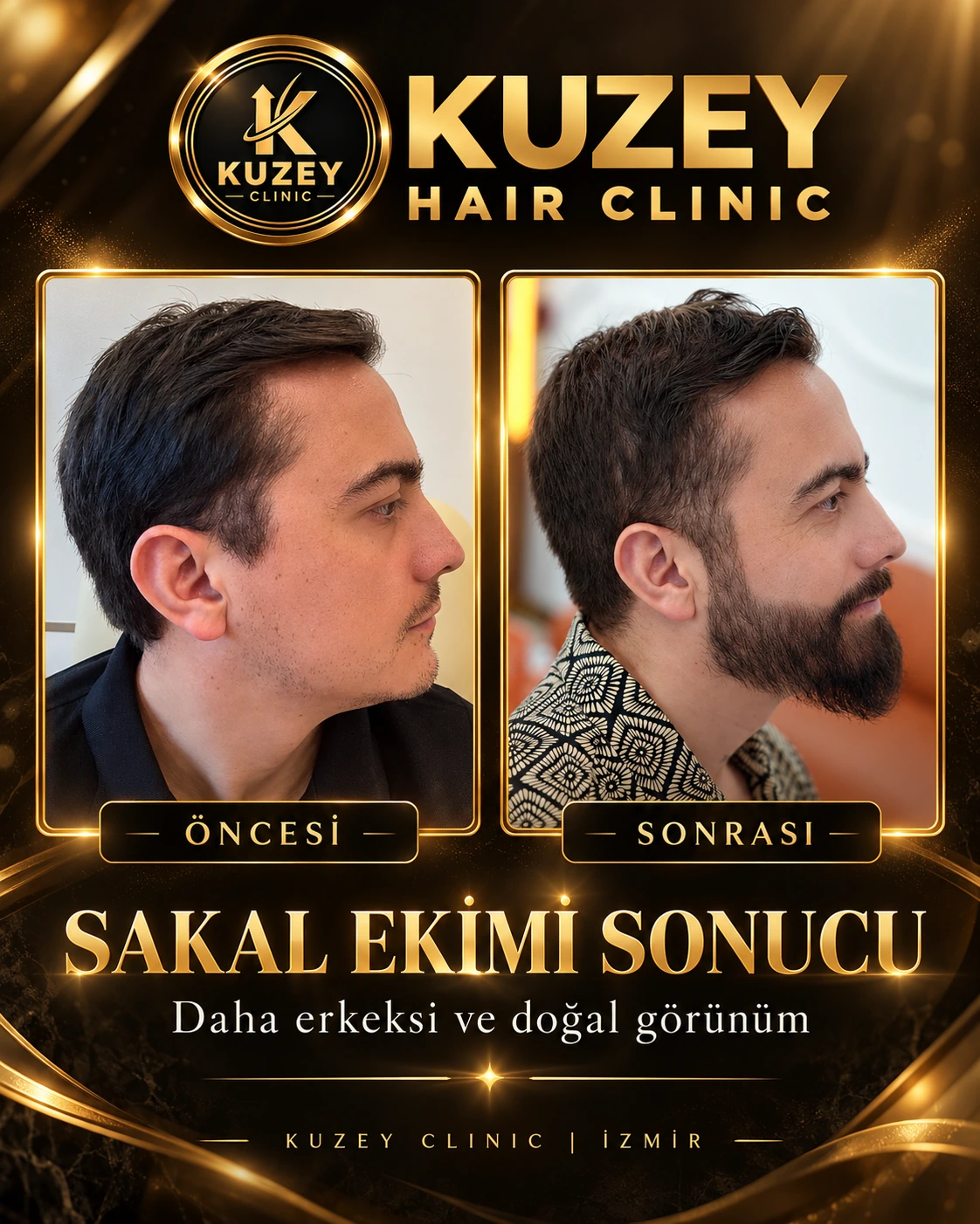 Kuzey Clinic sakal ekimi sonucu 7