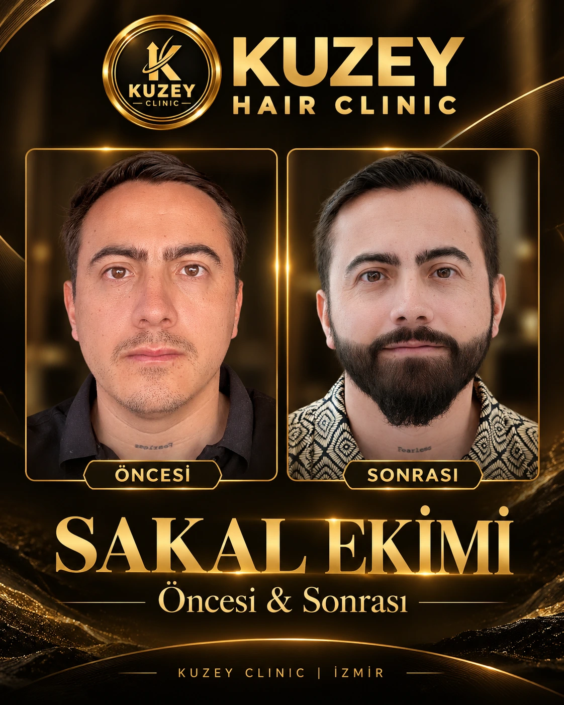 Kuzey Clinic sakal ekimi sonucu 8